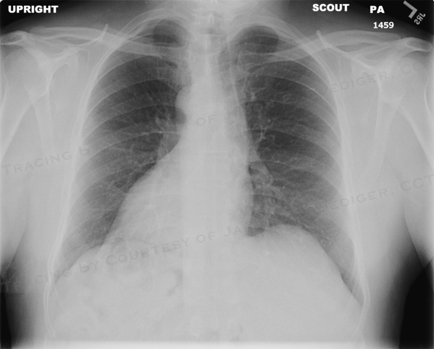 Jason s Blog ECG Challenge For The Month Of June 2014 ECG Guru